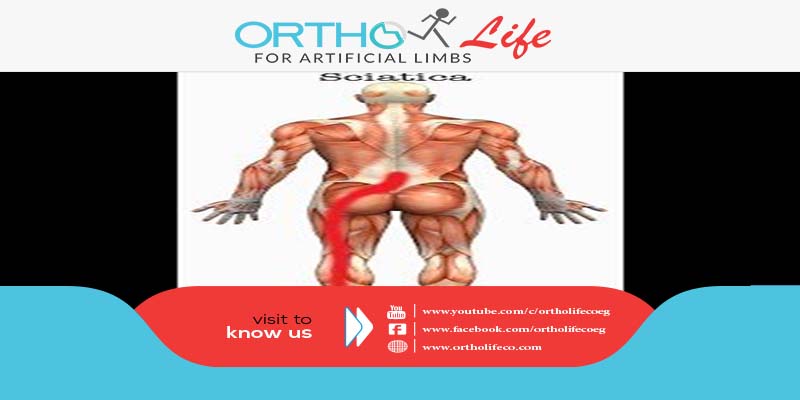 , أسباب مرض عرق النسا, ORTHO LIFE