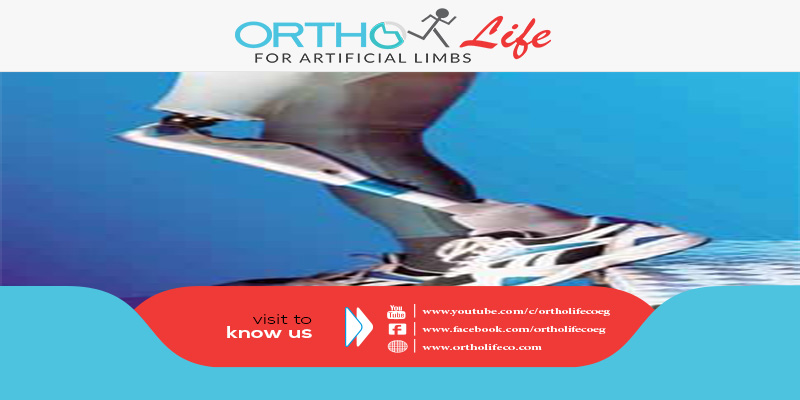 , ماهي عوامل نجاح الطرف الصناعي البديل ؟, ORTHO LIFE