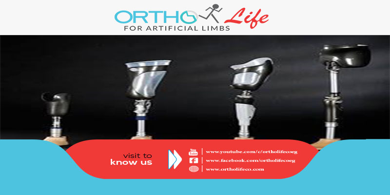 , ما هي أنواع المفاصل الصناعية ؟, ORTHO LIFE