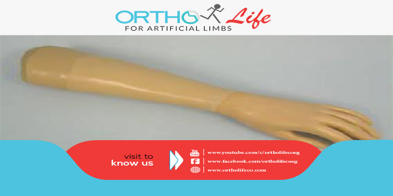 , ما هي مصادر الأطراف البديلة ؟ وهل هناك صناعة محلية ؟, ORTHO LIFE